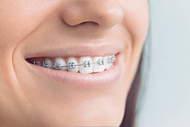 Laser Dentistry in Combine, TX
